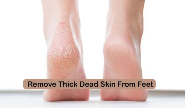 Remove Thick Dead Skin From Feet